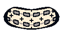 Braces